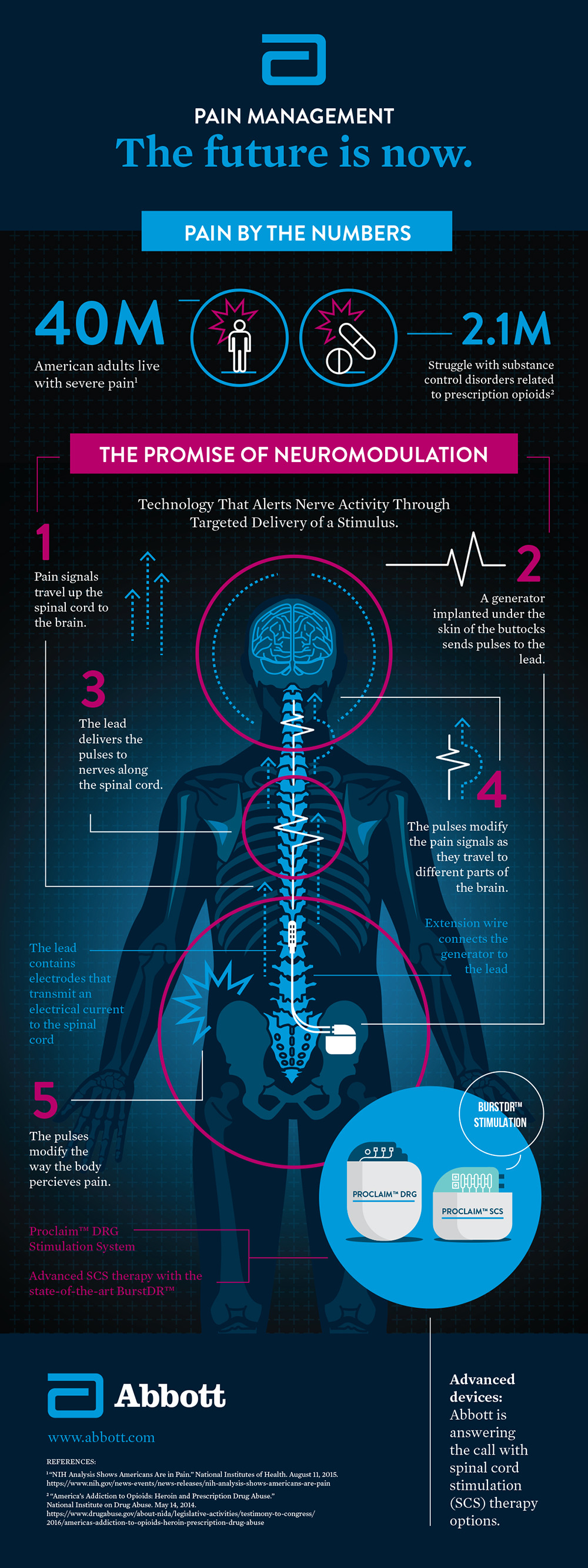 Abbott_Pain-Management-Infographic